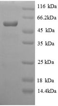 Recombinant Salmonella typhi Protein viaA (viaA), partial – Figure 1 of 1