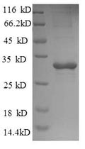 Recombinant Saccharomyces cerevisiae Trehalose-phosphatase (TPS2), partial – Figure 1 of 1