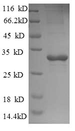 Recombinant Saccharomyces cerevisiae Trehalose-phosphatase (TPS2), partial – Figure 1 of 1