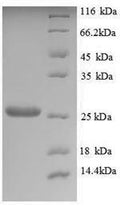 Recombinant Saccharomyces cerevisiae Trehalose-phosphatase (TPS2), partial – Figure 1 of 1