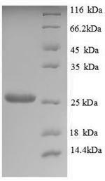 Recombinant Saccharomyces cerevisiae Trehalose-phosphatase (TPS2), partial – Figure 1 of 1