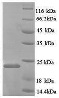 Recombinant Rat Nitric oxide synthase, endothelial (Nos3), partial – Figure 1 of 1
