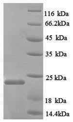 Recombinant Rat Nitric oxide synthase, endothelial (Nos3), partial – Figure 1 of 1