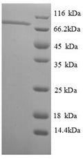 Recombinant Thermus aquaticus DNA polymerase I, thermostable (polA), partial – Figure 1 of 1