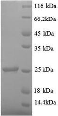 Recombinant Rat Metalloproteinase inhibitor 1 (Timp1) – Figure 1 of 1