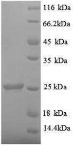 Recombinant Rat Metalloproteinase inhibitor 1 (Timp1) – Figure 1 of 1