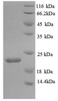 Recombinant Mouse Interleukin-18-binding protein (Il18bp) – Figure 1 of 1