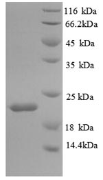 Recombinant Mouse Interleukin-18-binding protein (Il18bp) – Figure 1 of 1