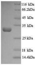 Recombinant Human Protein-lysine 6-oxidase (LOX), partial – Figure 1 of 1