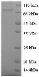 Recombinant Escherichia coli Inducible ornithine decarboxylase (speF) – Figure 1 of 1