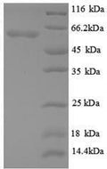 Recombinant Mouse Angiopoietin-2 (Angpt2), partial – Figure 1 of 1