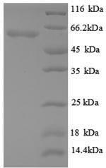 Recombinant Mouse Angiopoietin-2 (Angpt2), partial – Figure 1 of 1