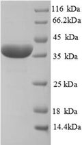 Recombinant Rat Haptoglobin (Hp), partial – Figure 1 of 1