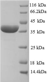 Recombinant Rat Haptoglobin (Hp), partial – Figure 1 of 1