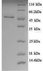 Recombinant Escherichia coli UDP-glucose 6-dehydrogenase (ugd), partial – Figure 1 of 1