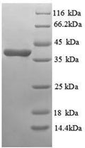 Recombinant Human Annexin A3 (ANXA3), partial – Figure 1 of 1