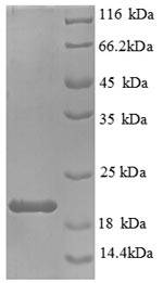 Recombinant Mouse Interleukin-1 beta (Il1b), partial – Figure 1 of 1