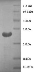 Recombinant Human Metallothionein-1G (MT1G), partial – Figure 1 of 1