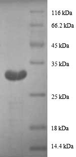 Recombinant Human Metallothionein-1G (MT1G), partial – Figure 1 of 1