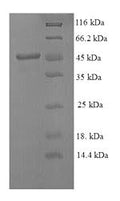 Recombinant Mouse Stromelysin-1 (Mmp3) – Figure 1 of 1