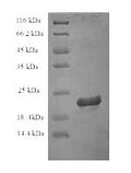 Recombinant Rat Interleukin-18 (Il18) – Figure 1 of 1