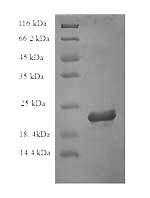 Recombinant Rat Interleukin-18 (Il18) – Figure 1 of 1