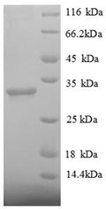 Recombinant Human Histone deacetylase 7 (HDAC7), partial – Figure 1 of 1