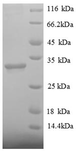 Recombinant Human Histone deacetylase 7 (HDAC7), partial – Figure 1 of 1