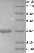 Recombinant Human Histone deacetylase 7 (HDAC7), partial – Figure 1 of 1