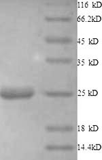 Recombinant Human Histone deacetylase 7 (HDAC7), partial – Figure 1 of 1