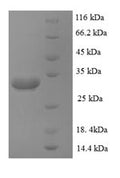 Recombinant Human Zinc transporter ZIP1 (SLC39A1), partial – Figure 1 of 1