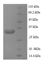 Recombinant Human Zinc transporter ZIP1 (SLC39A1), partial – Figure 1 of 1