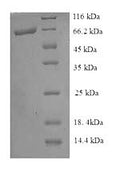 Recombinant Escherichia coli Pyruvate dehydrogenase [ubiquinone] (poxB) – Figure 1 of 1