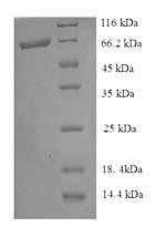 Recombinant Escherichia coli Pyruvate dehydrogenase [ubiquinone] (poxB) – Figure 1 of 1