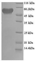 Recombinant Escherichia coli Pyruvate dehydrogenase [ubiquinone] (poxB), partial – Figure 1 of 1