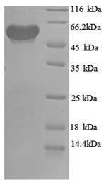 Recombinant Escherichia coli Pyruvate dehydrogenase [ubiquinone] (poxB), partial – Figure 1 of 1