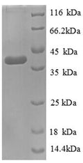 Recombinant Escherichia coli D-cysteine desulfhydrase (dcyD) – Figure 1 of 1