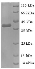 Recombinant Escherichia coli D-cysteine desulfhydrase (dcyD) – Figure 1 of 1
