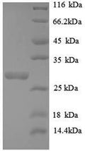 Recombinant Human Telomerase protein component 1 (TEP1), partial – Figure 1 of 1