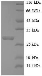 Recombinant Human Telomerase protein component 1 (TEP1), partial – Figure 1 of 1