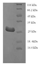 Recombinant Human Telomerase protein component 1 (TEP1), partial – Figure 1 of 1