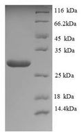 Recombinant Saccharomyces cerevisiae Neutral trehalase (NTH1), partial – Figure 1 of 1