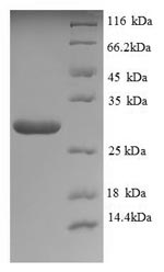 Recombinant Saccharomyces cerevisiae Neutral trehalase (NTH1), partial – Figure 1 of 1