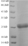 Recombinant Saccharomyces cerevisiae Neutral trehalase (NTH1), partial – Figure 1 of 1