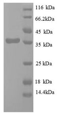 (Tris-Glycine gel) Discontinuous SDS-PAGE (reduced) with 5% enrichment gel and 15% separation gel.