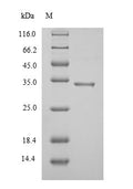 Recombinant Mycobacterium tuberculosis Diacylglycerol acyltransferase/mycolyltransferase Ag85A (fbpA), partial – Figure 1 of 