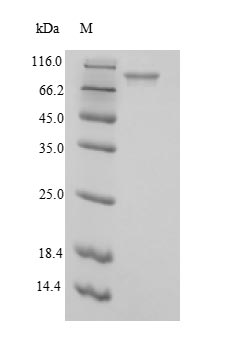 Recombinant Escherichia coli Phosphoenolpyruvate carboxylase (ppc), partial – Figure 1 of 1