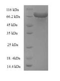 Recombinant Escherichia coli Glucose-6-phosphate 1-dehydrogenase (zwf), partial – Figure 1 of 1