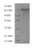 Recombinant Escherichia coli Glucose-6-phosphate 1-dehydrogenase (zwf), partial – Figure 1 of 1