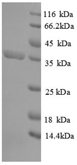 Recombinant Escherichia coli Dihydrodipicolinate synthase (dapA) – Figure 1 of 1